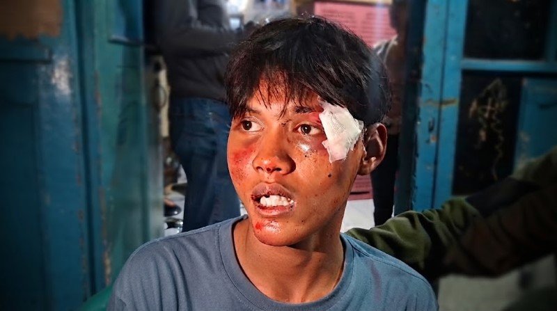 BIADAB! Warga Pejompongan Diseret dari Gang Rumah Lalu Dihajar Intel Tanpa Ampun Saat Kericuhan Demo 27 Agustus
